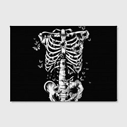 Холст прямоугольный Floral Skeleton, цвет: 3D-принт — фото 2