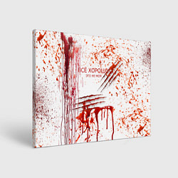 Холст прямоугольный Кровь с царапинами заляпанная, цвет: 3D-принт