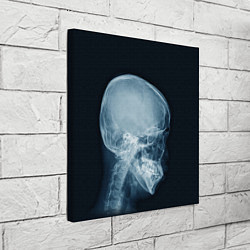 Холст квадратный Рентген головы, цвет: 3D-принт — фото 2