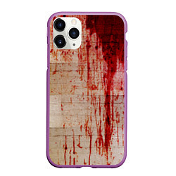 Чехол iPhone 11 Pro матовый Бинты 1, цвет: 3D-фиолетовый