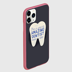 Чехол iPhone 11 Pro матовый Amazing Dentist, цвет: 3D-малиновый — фото 2