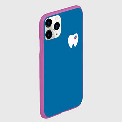 Чехол iPhone 11 Pro матовый Стоматолог, цвет: 3D-фиолетовый — фото 2
