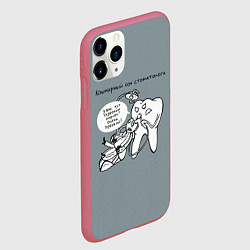 Чехол iPhone 11 Pro матовый Кошмарный сон стоматолога, цвет: 3D-малиновый — фото 2