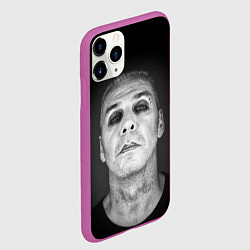 Чехол iPhone 11 Pro матовый LINDEMANN, цвет: 3D-фиолетовый — фото 2