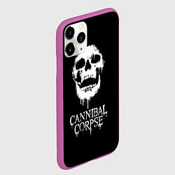 Чехол iPhone 11 Pro матовый Сannibal Сorpse $$$, цвет: 3D-фиолетовый — фото 2