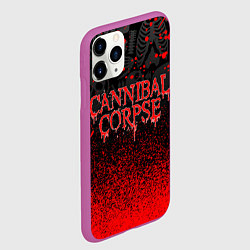 Чехол iPhone 11 Pro матовый CANNIBAL CORPSE, цвет: 3D-фиолетовый — фото 2