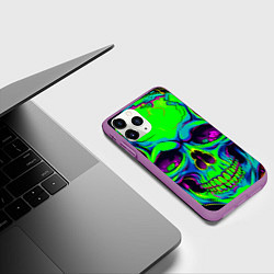 Чехол iPhone 11 Pro матовый Ярко кислотный череп в наушниках, цвет: 3D-фиолетовый — фото 2