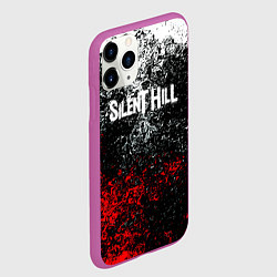 Чехол iPhone 11 Pro матовый Silenthill брызги красок, цвет: 3D-фиолетовый — фото 2
