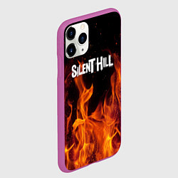 Чехол iPhone 11 Pro матовый Silent hill огонь, цвет: 3D-фиолетовый — фото 2