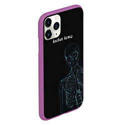 Чехол iPhone 11 Pro матовый Broken bones, цвет: 3D-фиолетовый — фото 2