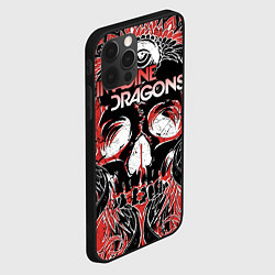 Чехол для iPhone 12 Pro Imagine Dragons, цвет: 3D-черный — фото 2