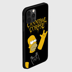 Чехол для iPhone 12 Pro Cannibal Corpse Симпсоны Гомер рокер, цвет: 3D-черный — фото 2