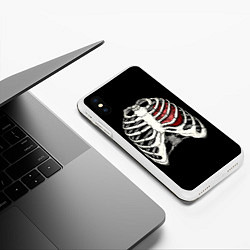 Чехол iPhone XS Max матовый My Heart, цвет: 3D-белый — фото 2