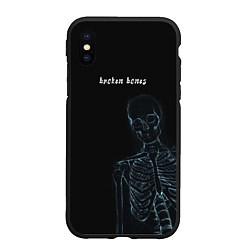Чехол iPhone XS Max матовый Broken bones, цвет: 3D-черный